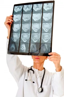 Na Slovensku je ročne diagnostikovaných približne 500 prípadov lymfómu – zhubného nádorového ochorenia lymfatického systému