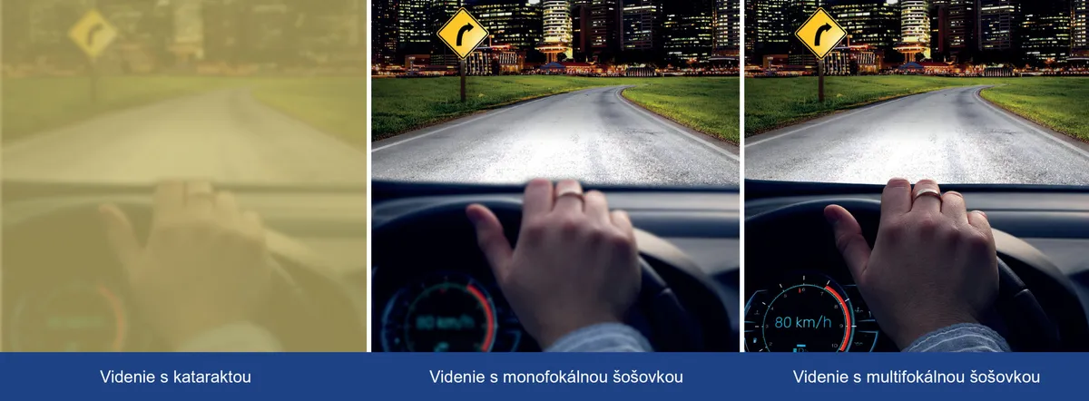 Umelé šošovky sú dnes moderné, pomáhajú lepšie vidieť