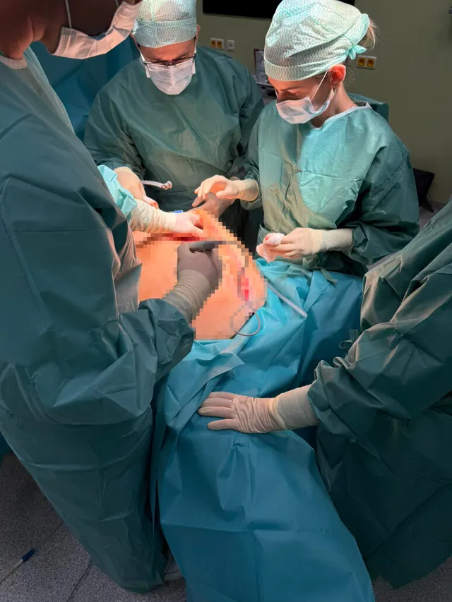 Pacientke odstránili 18 kilogramový nádor, žila s ním desať rokov